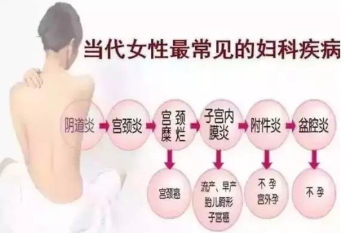 女性妇科疾病最新研究与进展概览